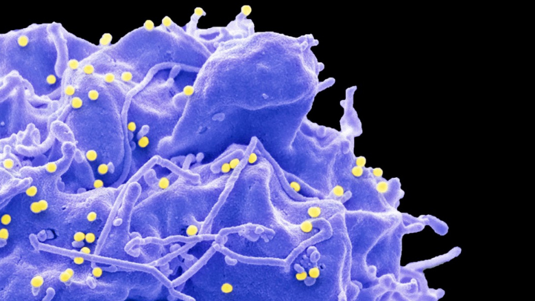HIV infected cell electron micrograph 1903x558