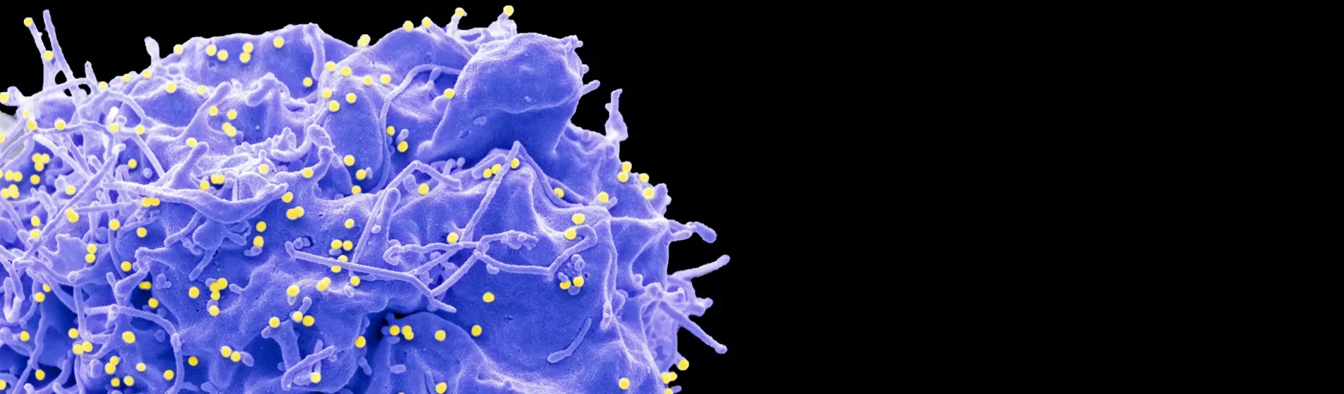 HIV infected cell electron micrograph 1903x558
