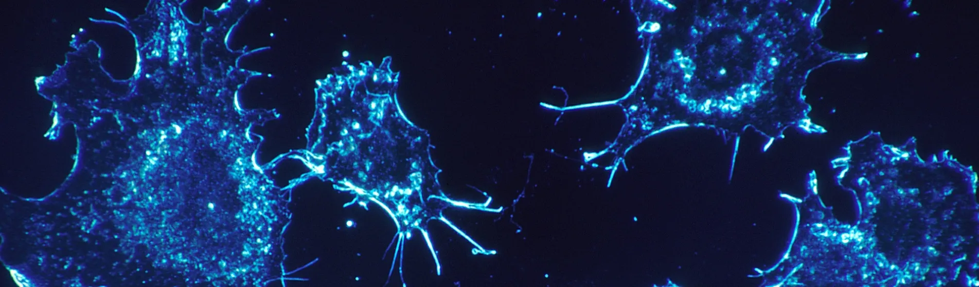 cancer-cells-blue