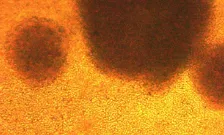 Car t cells growing in bag