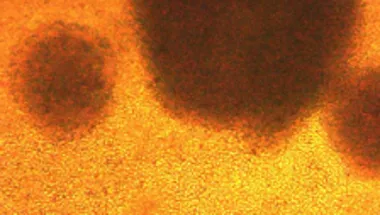 Car t cells growing in bag