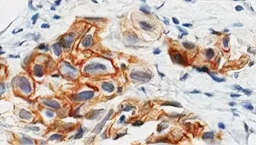 Department of Precision and Population Oncology