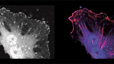 Invasion and Metastasis Research Group