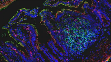Advancing Immune-Based Therapies for Precision Medicine and Disease Modulation