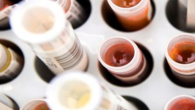 Cancer Antibody Discovery & Immunotherapy Group