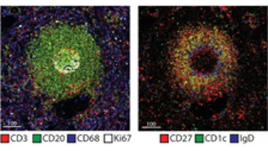 Human B cells Spencer Lab