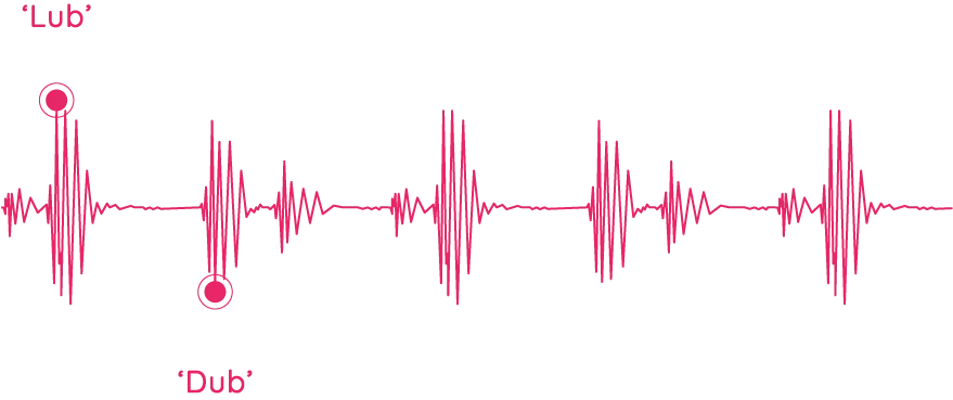 echoes web-trace-2-1