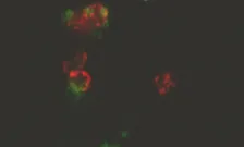 Ferro lab project 3 platelets