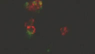 Ferro lab project 3 platelets