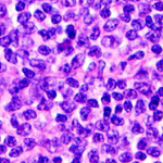 Leukaemia & Myeloma logo