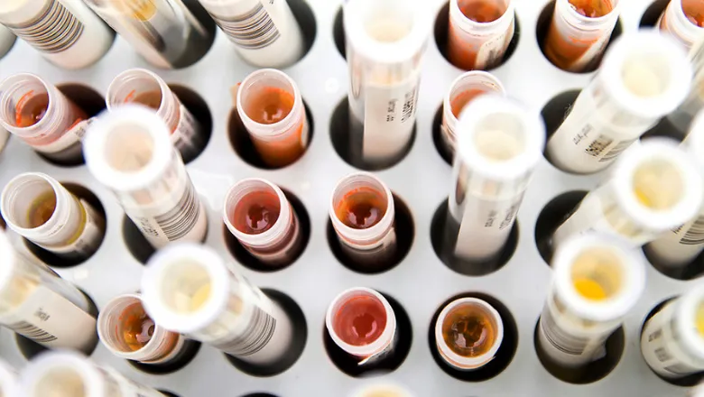 Image of blood samples in test tubes