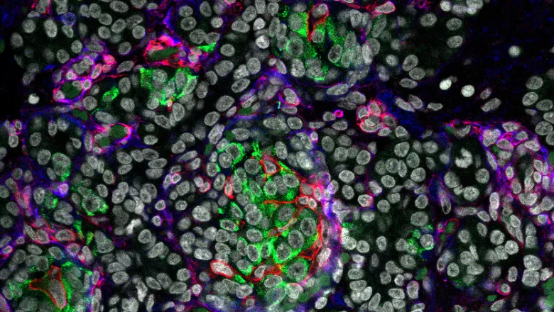 Immunofluorescence Microscopy image of human fetal pancreatic tissue