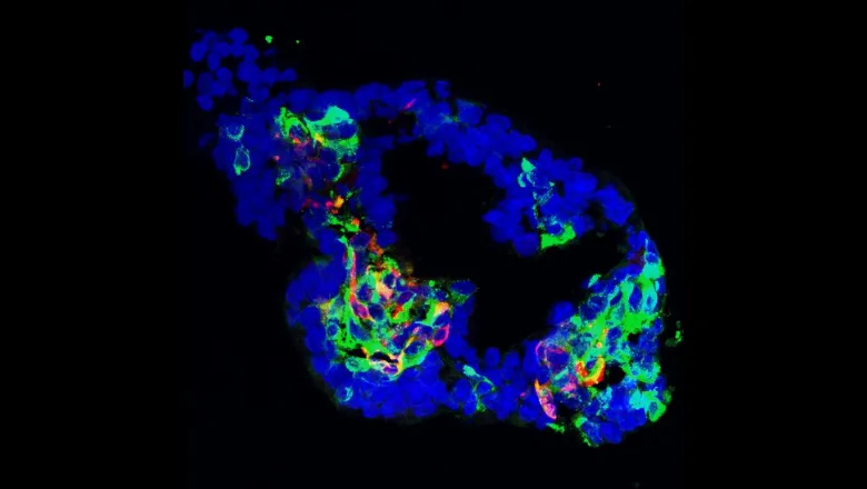 iPSCs derived beta cells using the organoid system