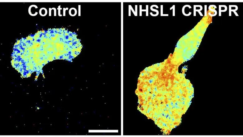 NHSL1-FLIM-TIFF