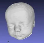 3D MRI virtual model of 
33 week old unborn baby