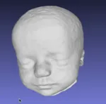 3D MRI virtual model of
33 week old unborn baby
