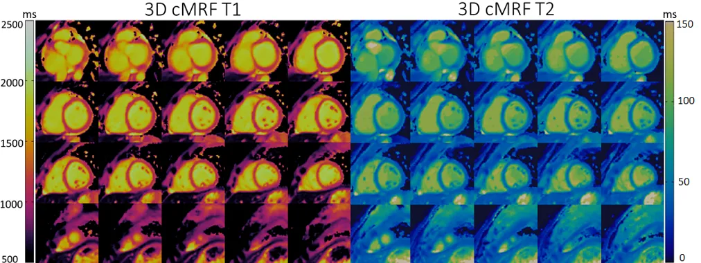 3D volume of the heart