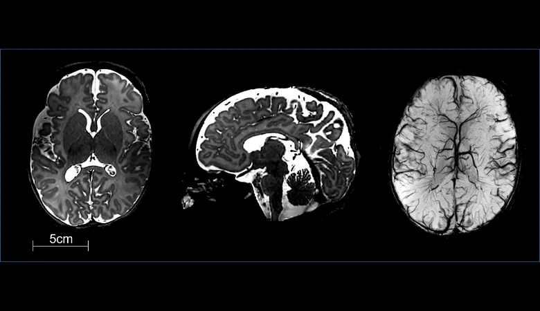 baby-brain-scan-anonymised