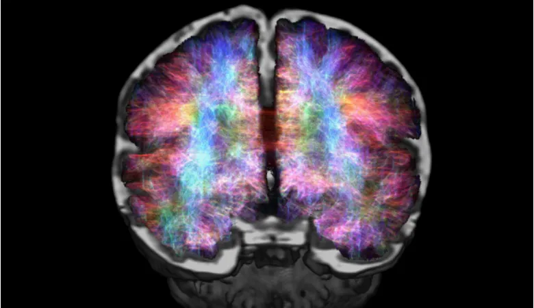 brain-connectomes-baby