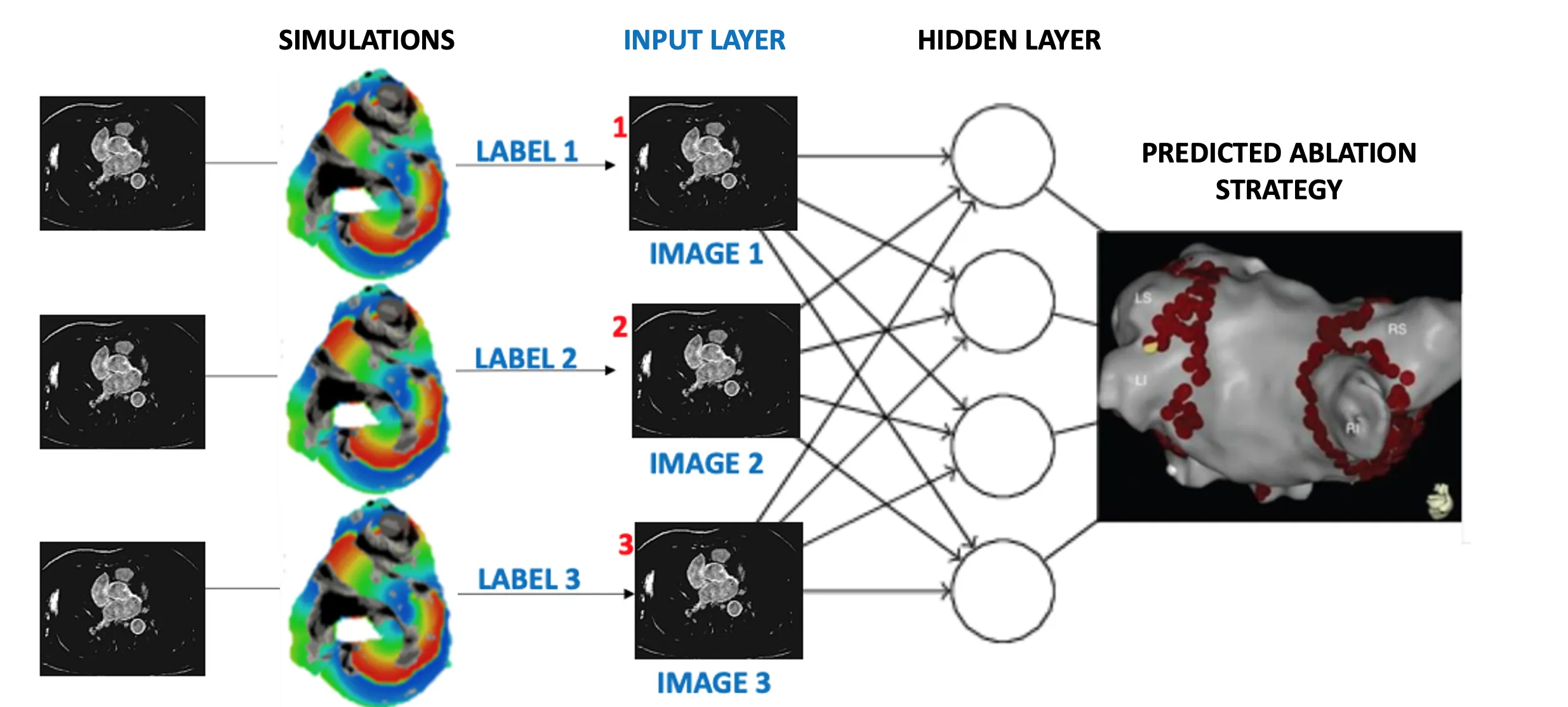 Proposed workflow for assigning labels to patient MR images based on image-derived 3D simulations of atrial electrical activation.