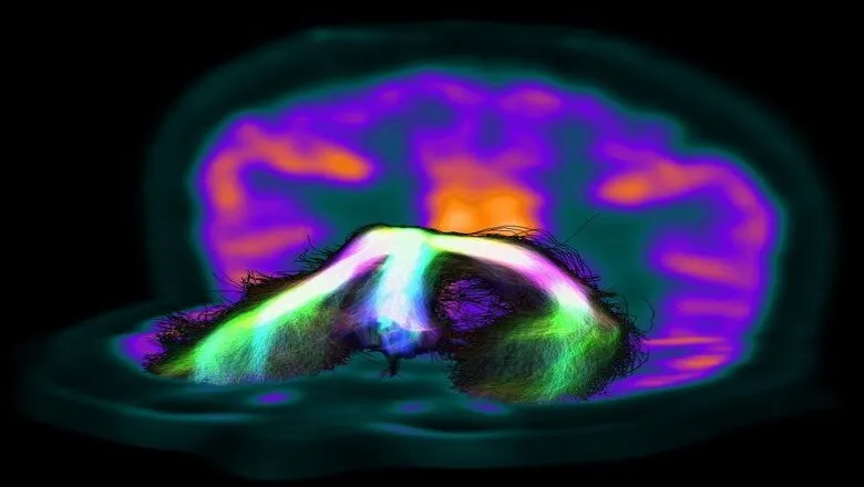 MRI main image