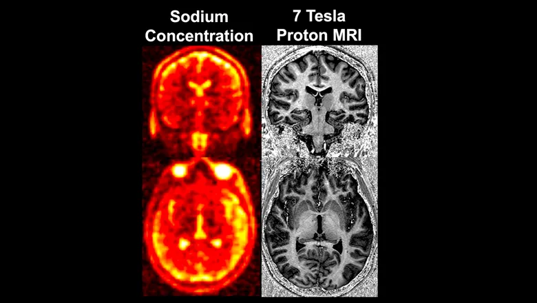 sodium-scanning David C