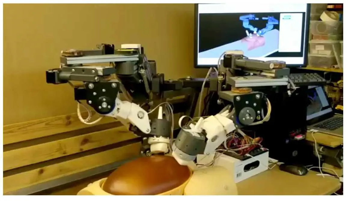 Figure to illustrate the dual-arm ultrasound scanning robot at St. Thomas' hospital.