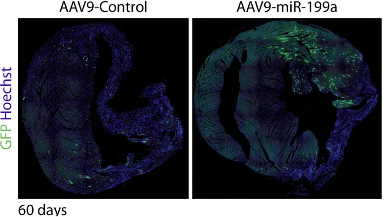CycleTrack system on mouse hearts