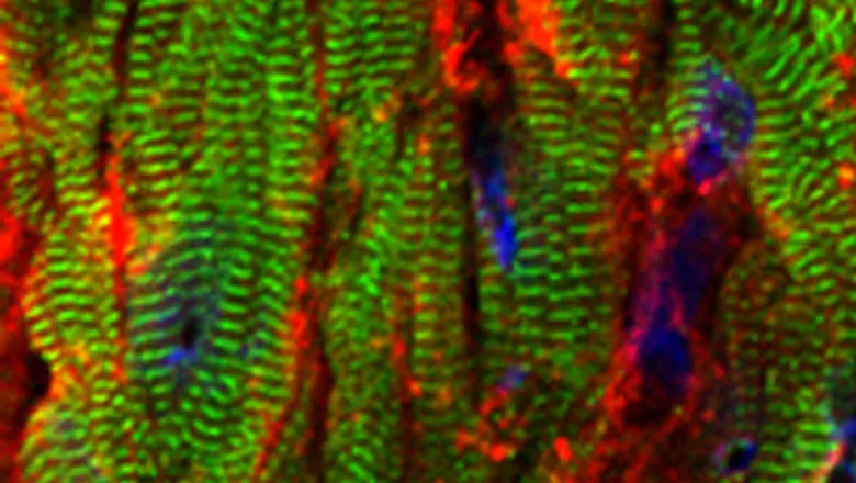 Image for King's BHF special seminar, Stephan Lange