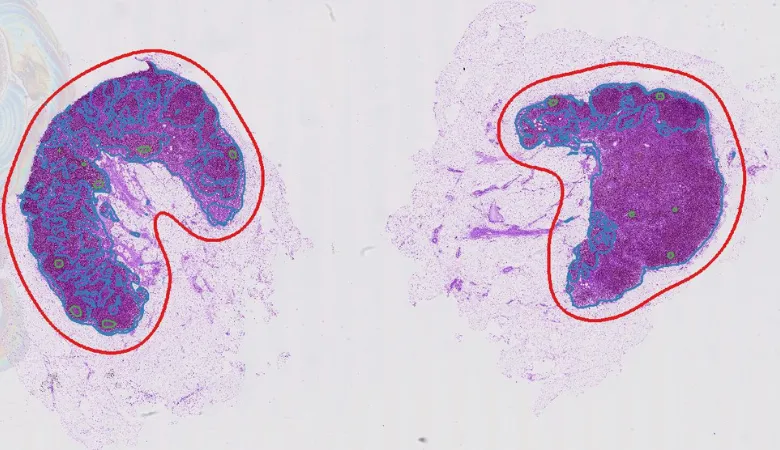 ai-lymph-nodes