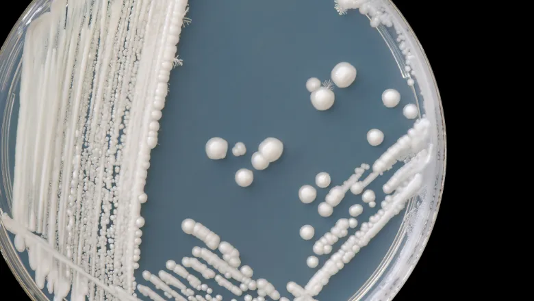 Candida Auris