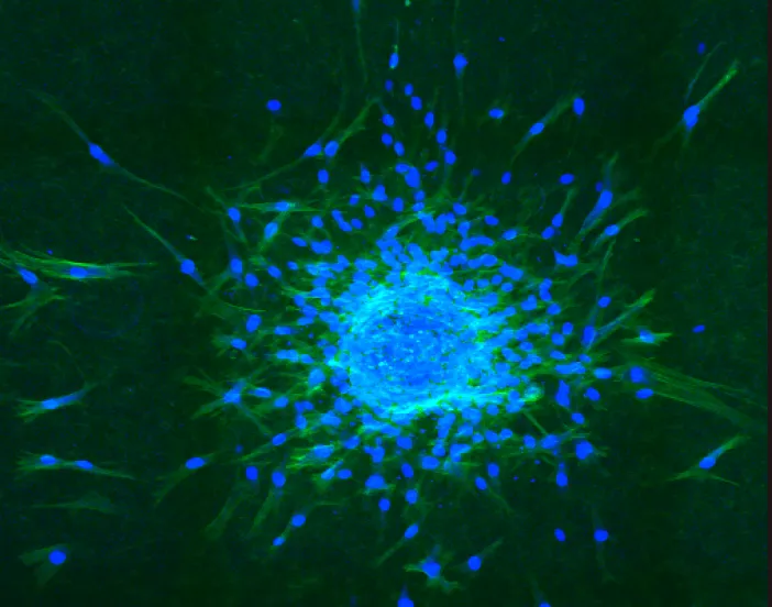 Fibroblasts migrate from a spheroid in a 3D collagen environment