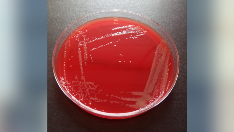 New bacterial species Jan 2024 v2 780x450