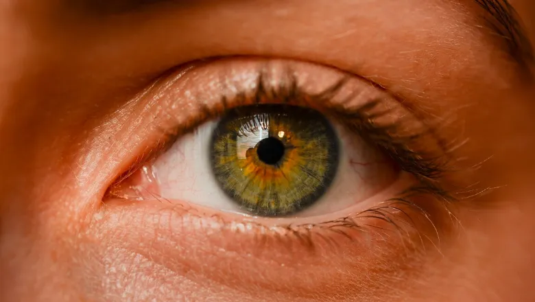 myopia-eye