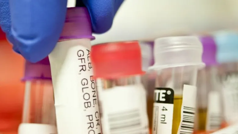 scientist handling a selection of samples
