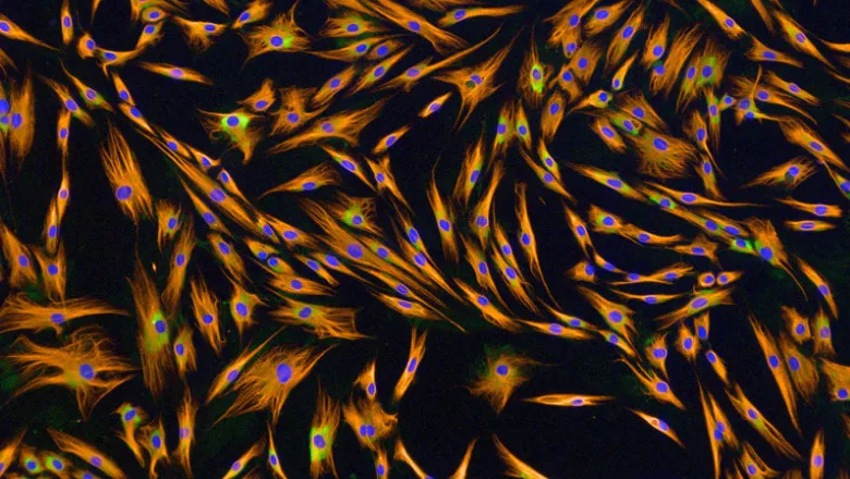 stem-cells-lunch-780-x-440