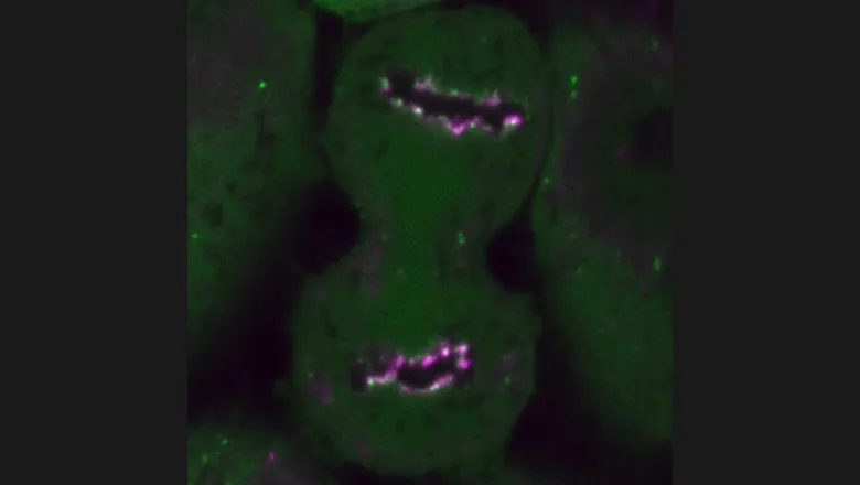 bmb-organelle-remodelling