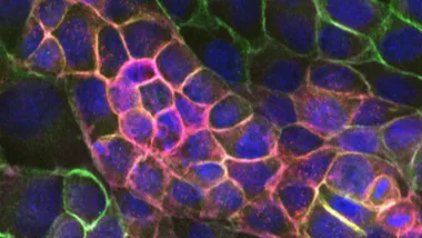 cellular monolayers
