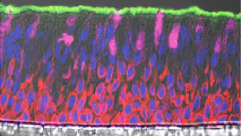 Deconstructing ubiquitin regulation of ion channels