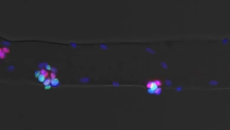Molecular regulation of skeletal muscle plasticity and regeneration