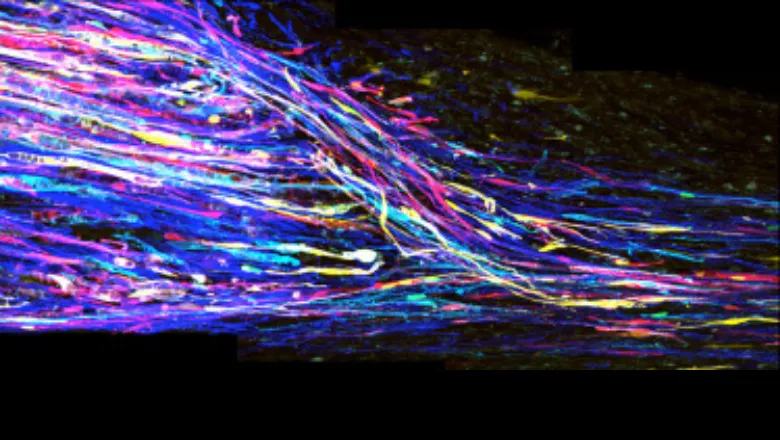 Peripheral nerves