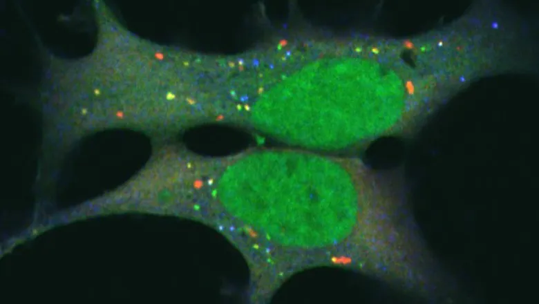 Kinase in autophagy