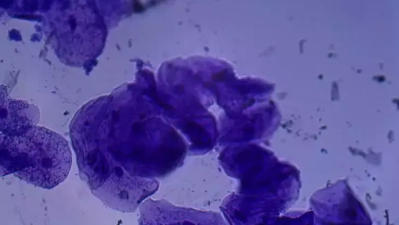 cheek cells