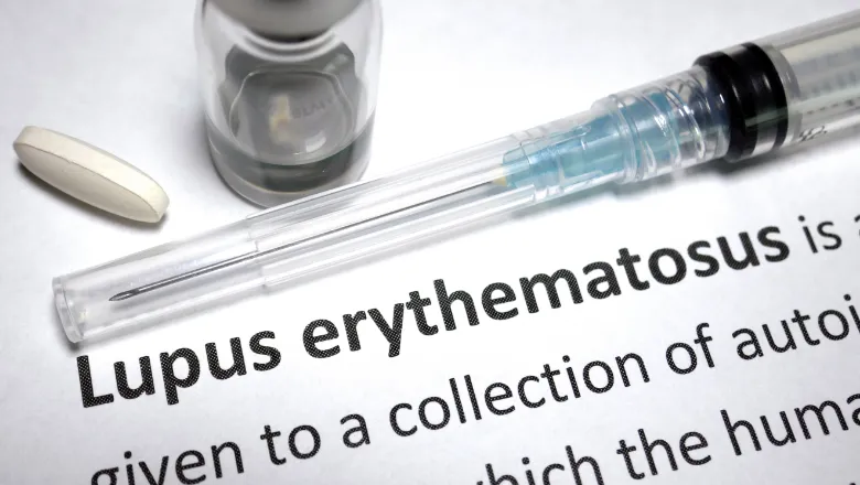 Lupus erythematosus picture 780x450