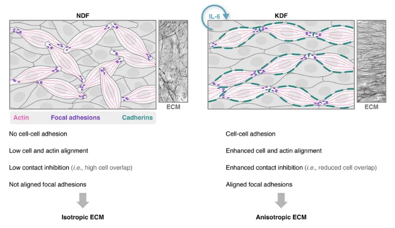 Schematic highlighting the IL-6 mediated mechanism of scar fibroblast ECM anisotropy.
