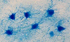 motor neurons in vitro 224x135
