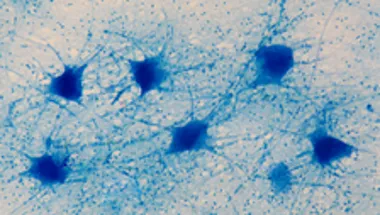 motor neurons in vitro 224x135