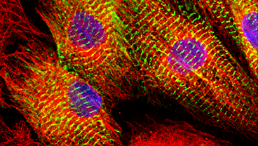 Muscle Biophysics