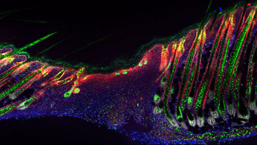 Centre for Gene Therapy & Regenerative Medicine