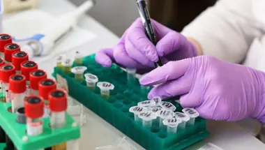 test tube